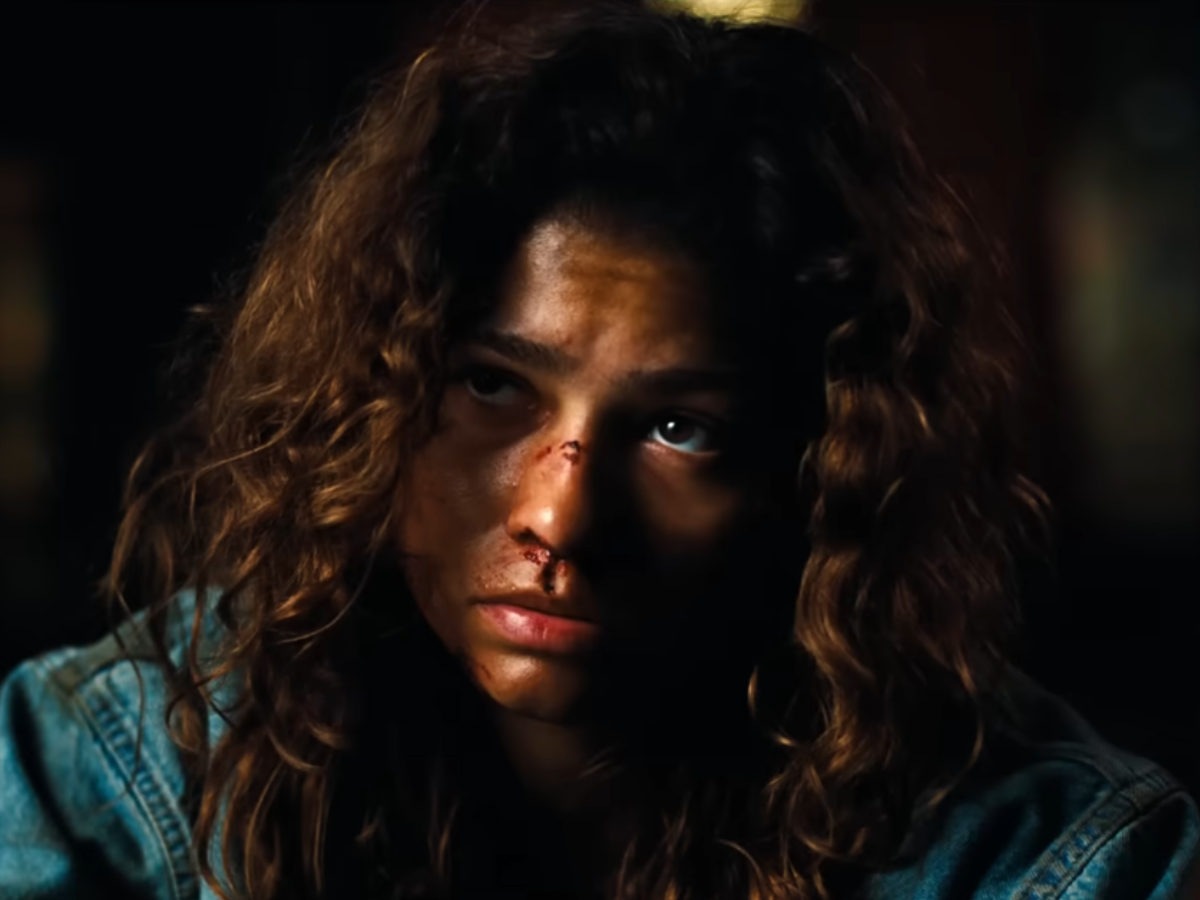 Close-up of a young woman with a bruised nose and scratches on her cheek, looking solemnly to the side in low light.