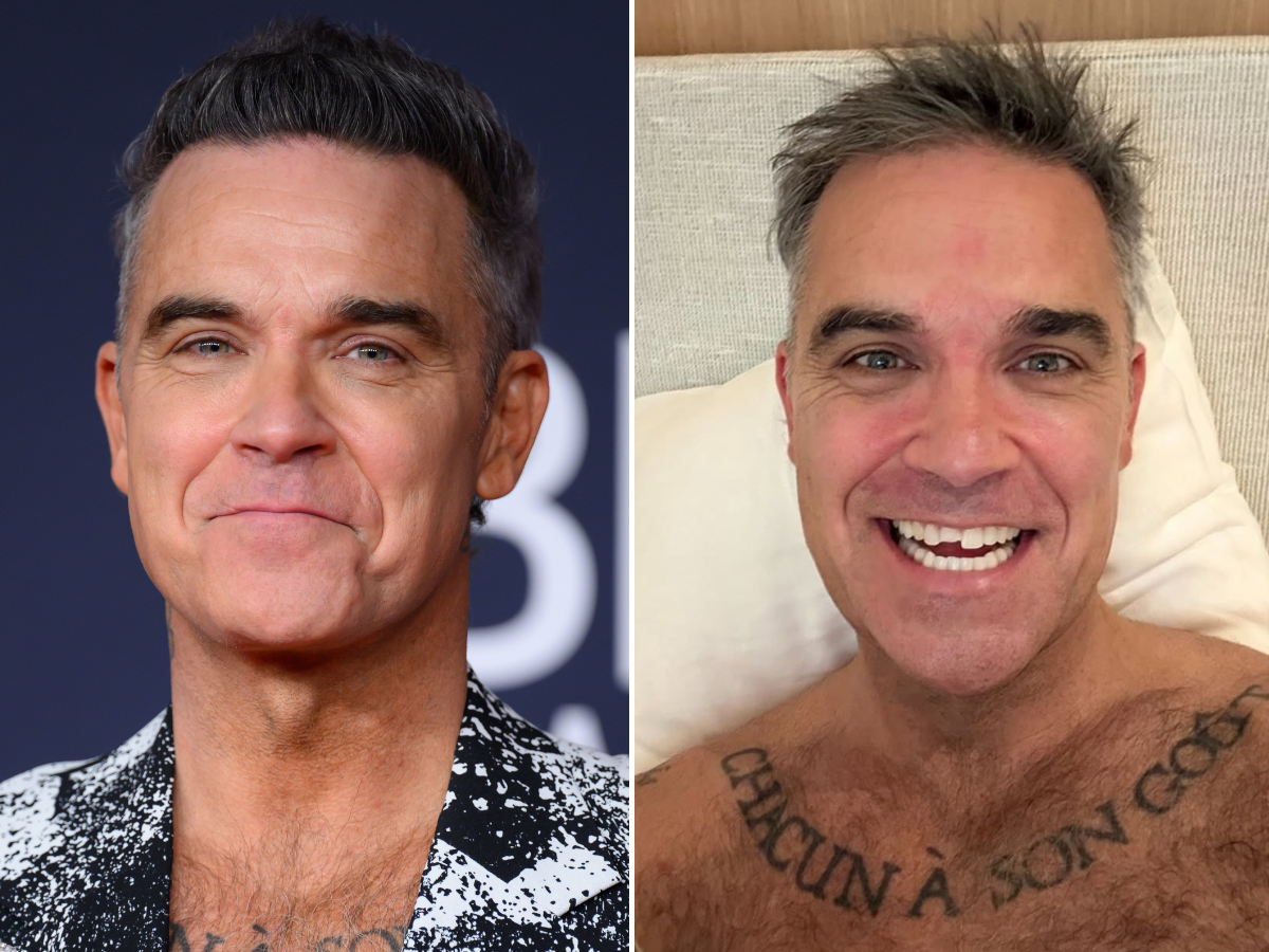 Robbie Williams perde mezzo dente: “E ora ho degli show in arrivo”