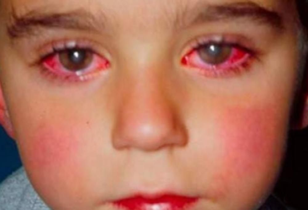 Questo bambino ha perso il 75% della sua vista per un giocattolo che probabilmente avete a casa