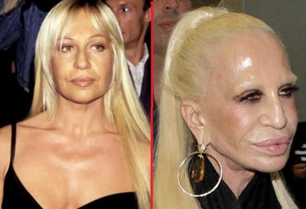 VIP: i disastri della chirurgia estetica