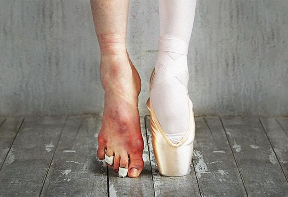 La fatica delle ballerine in 15 meravigliose foto