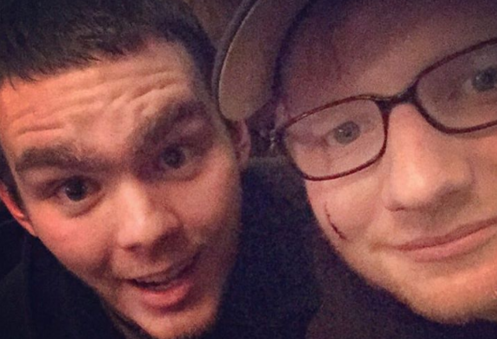 Ed Sheeran ferito al volto dalla principessa Beatrice