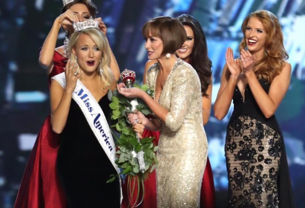 Ha una malattia della pelle, ma si candida a Miss Universo Malesia