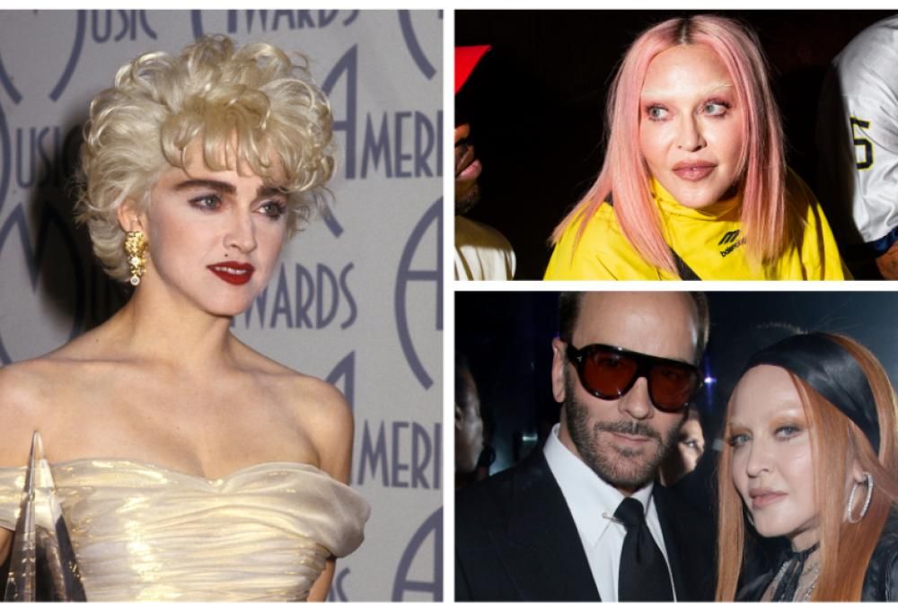 Madonna, che faccia! I chirurghi plastici dicono la loro