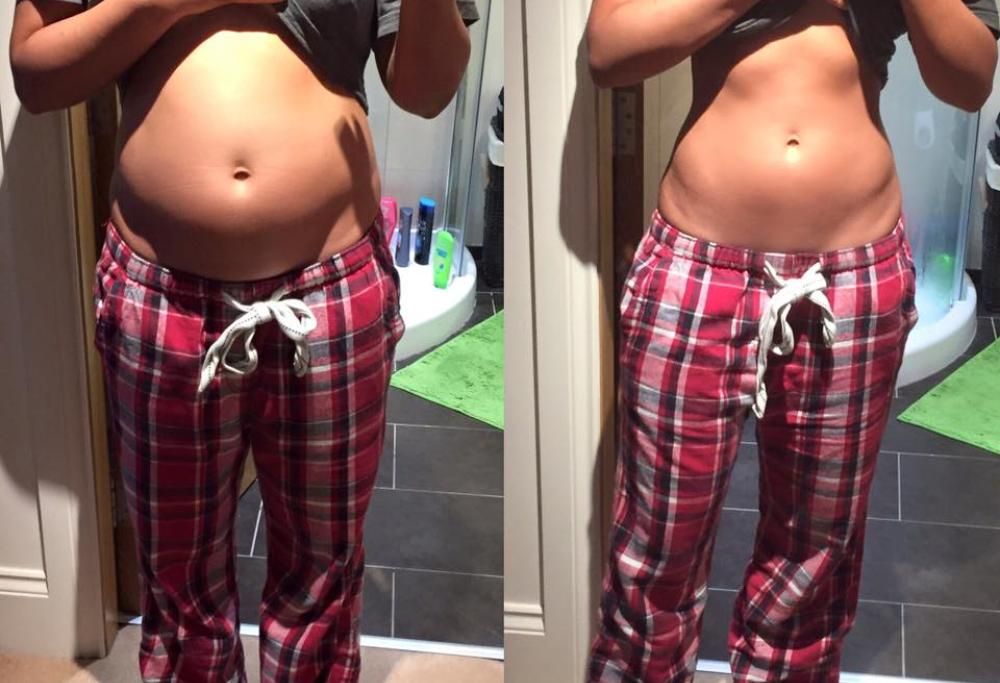 Due foto alla pancia a distanza di 12 ore: “Succede a tutte, ragazze. Nessuno è perfetto”.