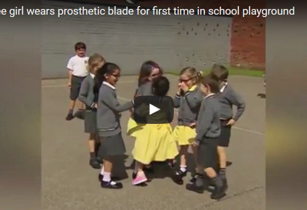 La bimba torna a scuola con la protesi alla gamba. La reazione dei compagni è commovente