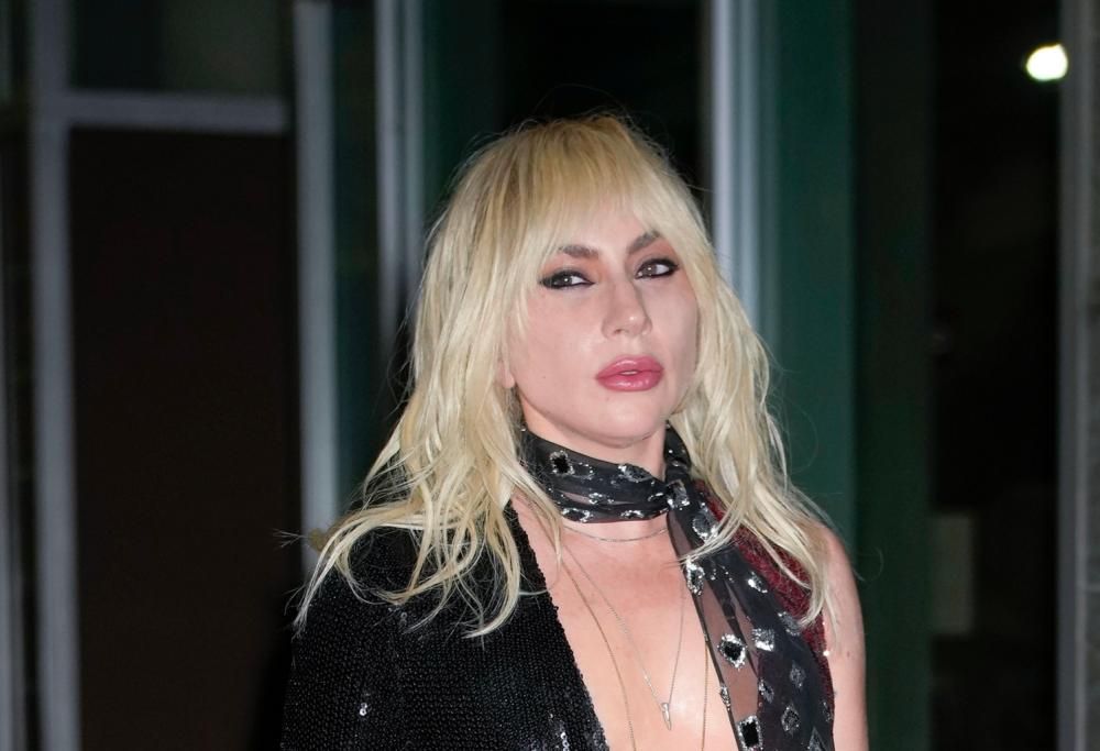 Lady Gaga fa una sorpresa a dei fan speciali. Il video