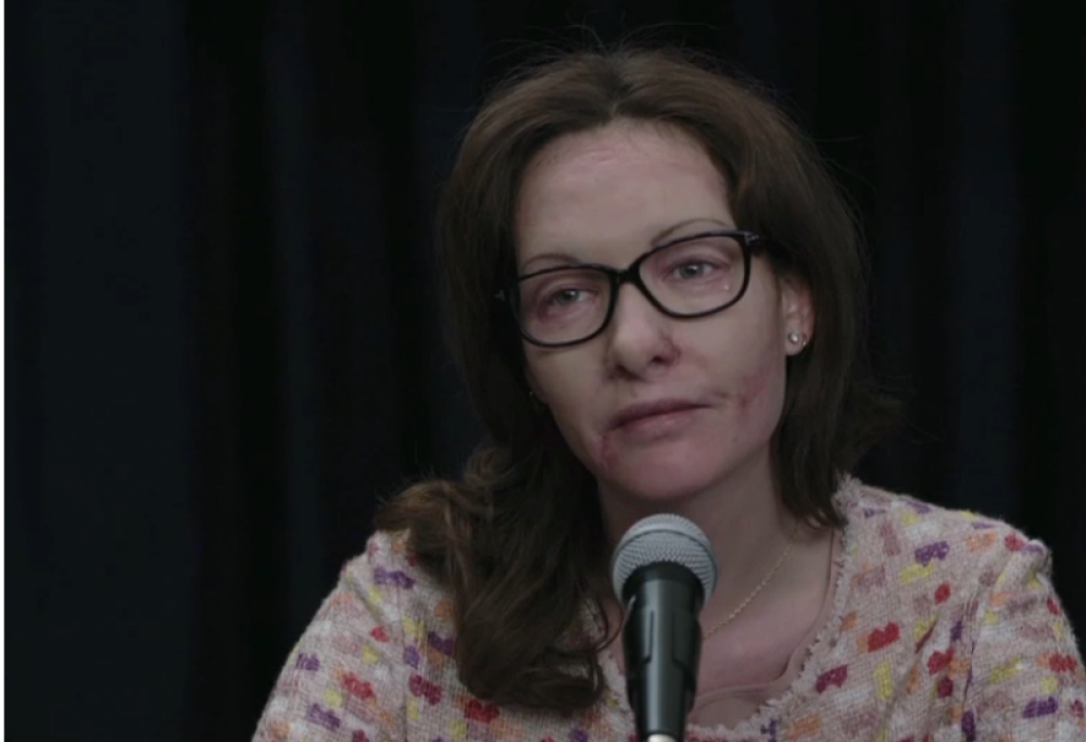 Cristiana Capotondi sarà Lucia Annibali in una fiction tv