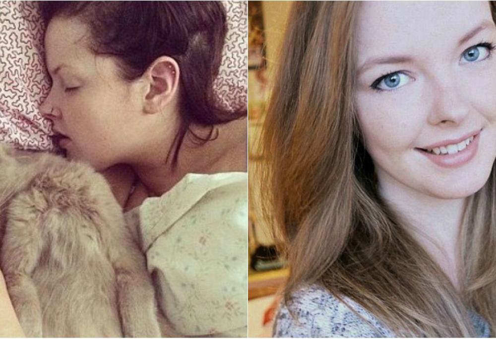 Dormire per 40 ore consecutive. La “sindrome della Bella Addormentata” che colpisce i teenagers