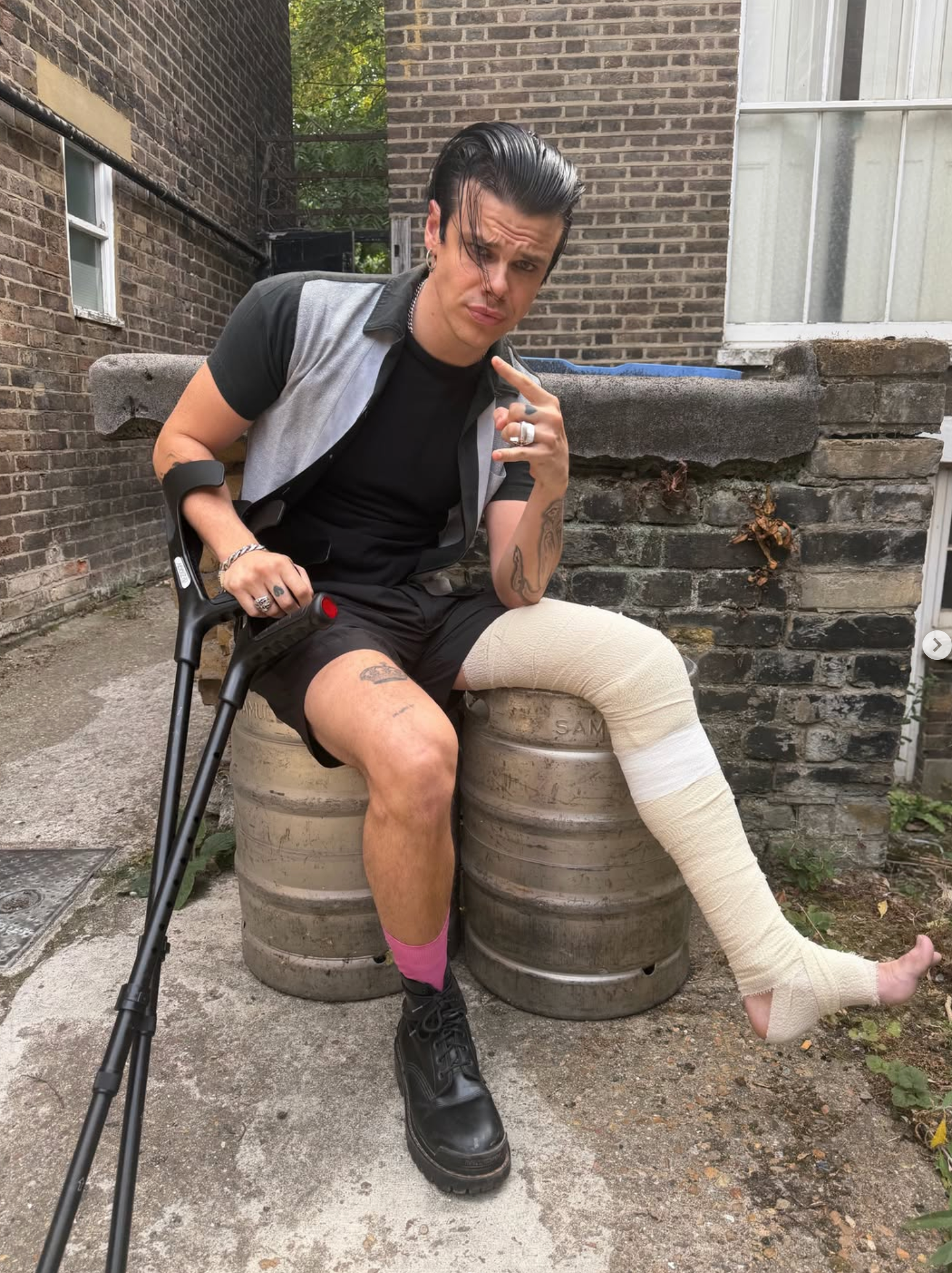 Man with a wrapped leg cast sits on beer kegs outside a brick building, holding up a peace sign with his right hand.