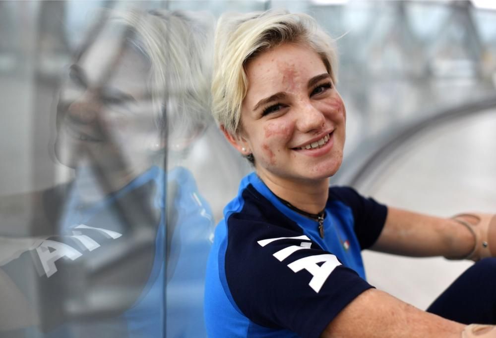 Bebe Vio  coraggiosa e irresistibile: il nuovo post!