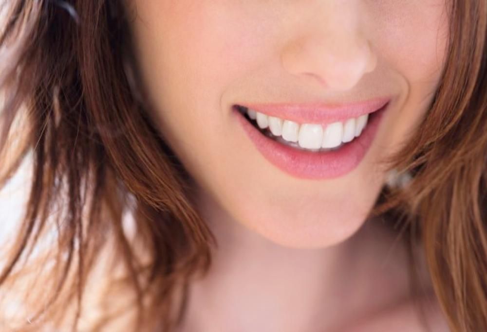 Lo sbiancamento dentale classico